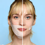 Hormonal Acne Bundle